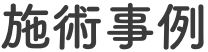 施術事例